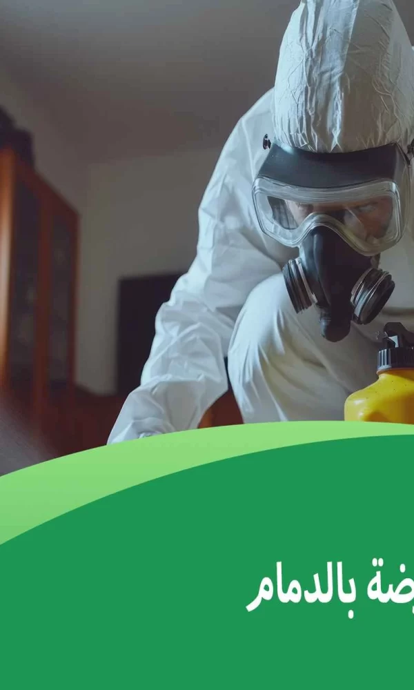 شركة مكافحة الارضة بالدمام