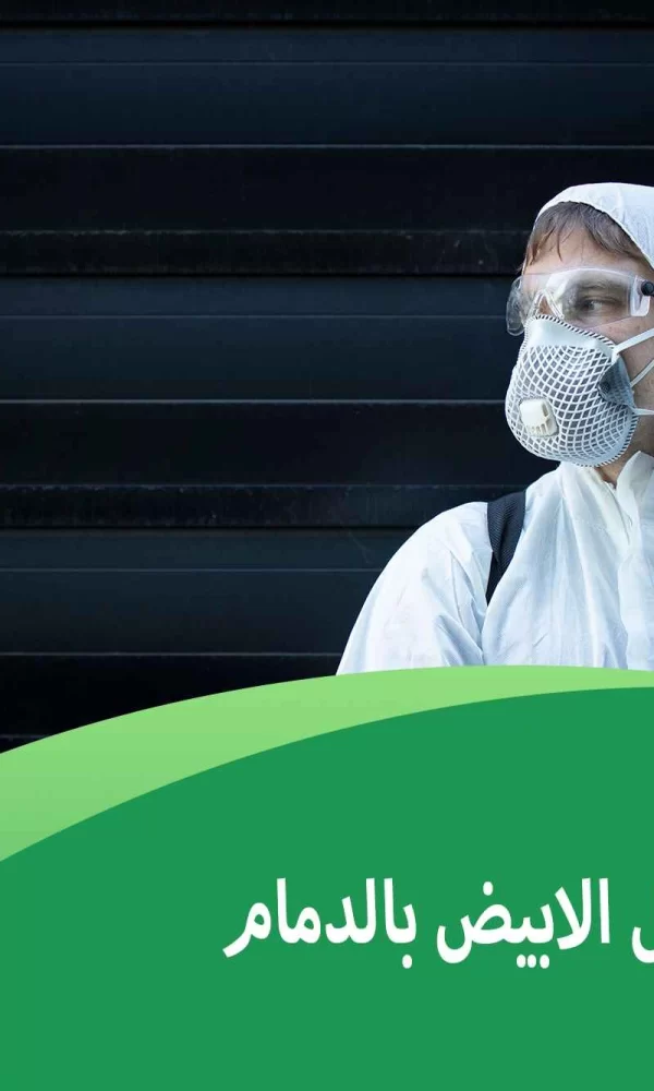 شركة مكافحة النمل الابيض بالدمام