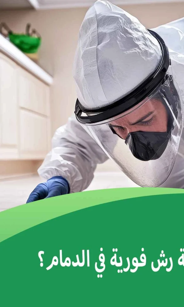 هل يوجد شركة رش فورية في الدمام؟